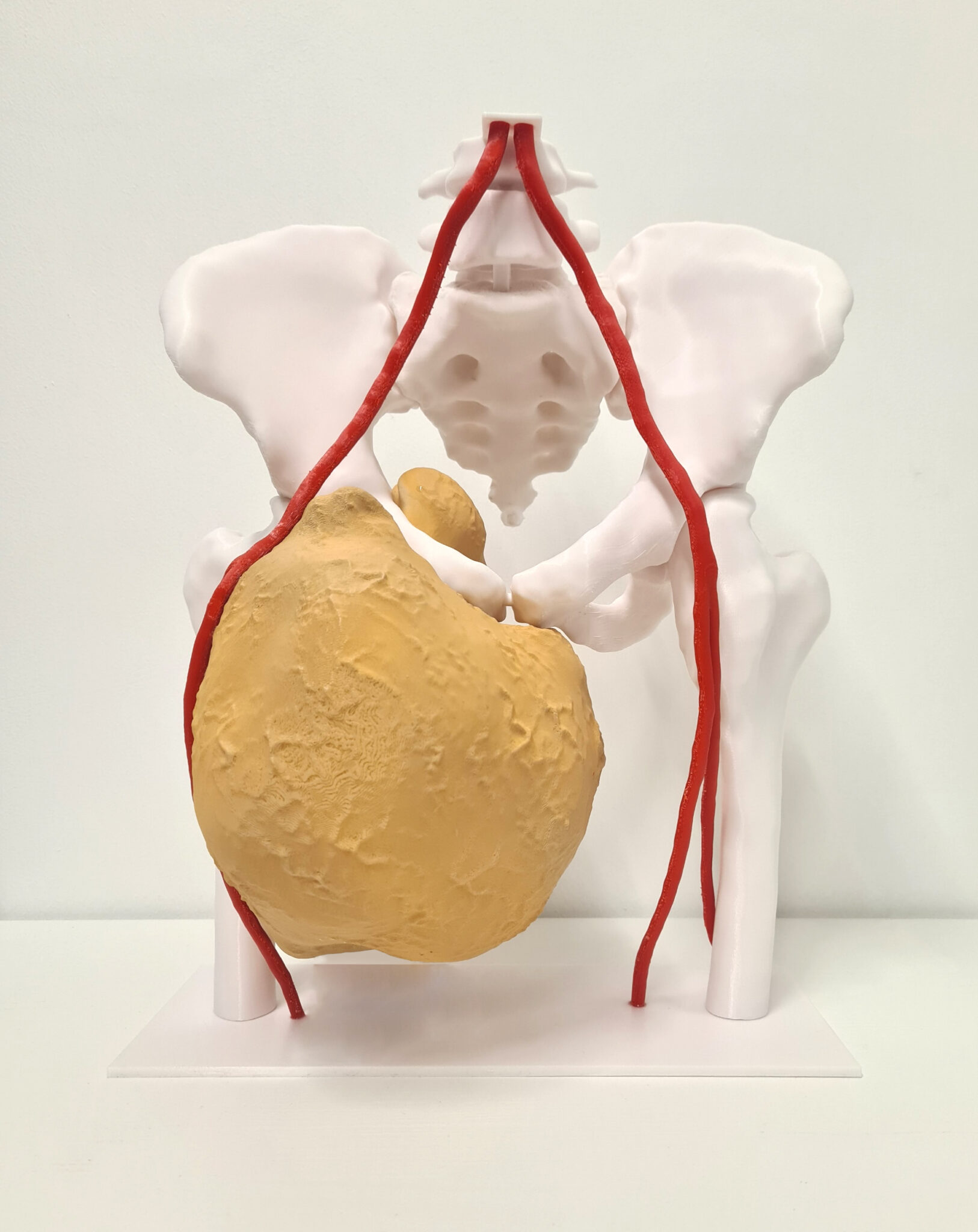 Création de modèle anatomique en impression 3D pour le domaine médical ...