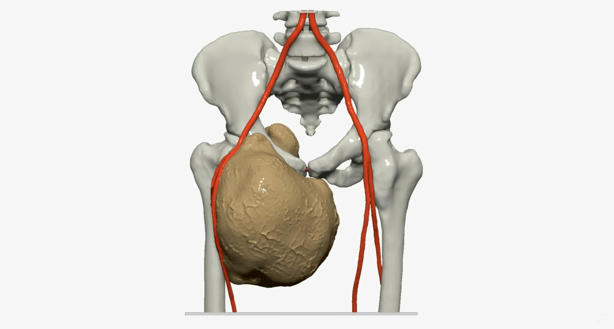 https://azurmedia.fr/wp-content/uploads/creation-modele-anatomique-modelisation-3d-impression-3d-domaine-medical-scanner-medical-irm-dicom-scaled.jpg